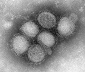 close-up of H1N1 virus